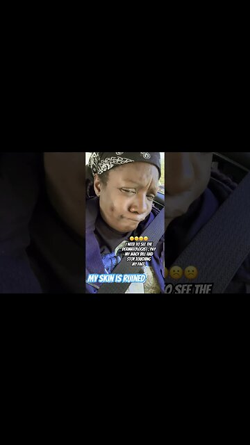 I need help. Does anyone have skin care tips #blackyoutube #skincare#natural#shorts