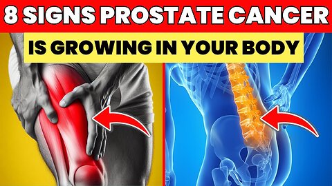 Don't Miss These 8 Early Prostate Cancer Signs – It Could Save You!