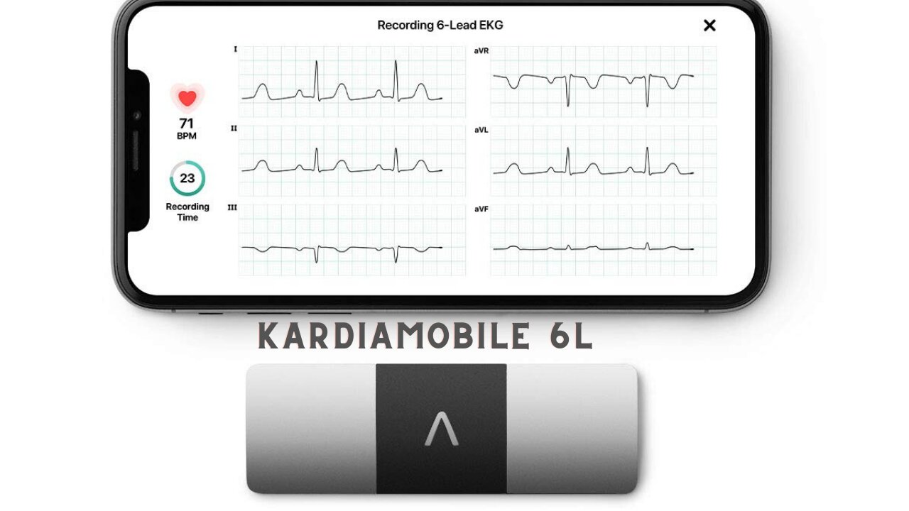 Alivecor kardiamobile 6l