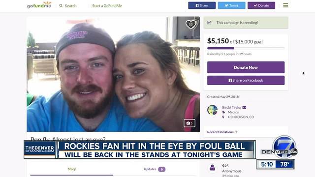 Rockies fan hit in eye by foul ball on Sunday being hosted by team at Wednesday night's game