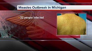 Measles outbreak in Michigan; 22 people infected