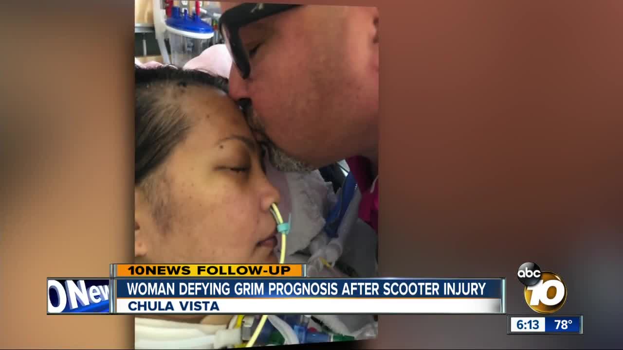 Woman defying grim prognosis after scooter accident