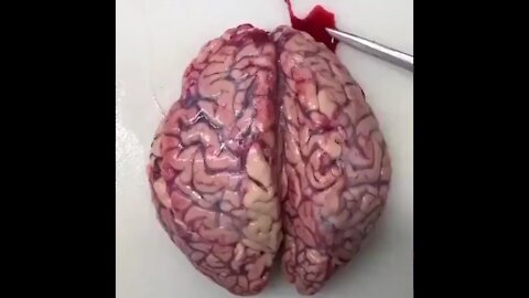 Vaxxbrain??