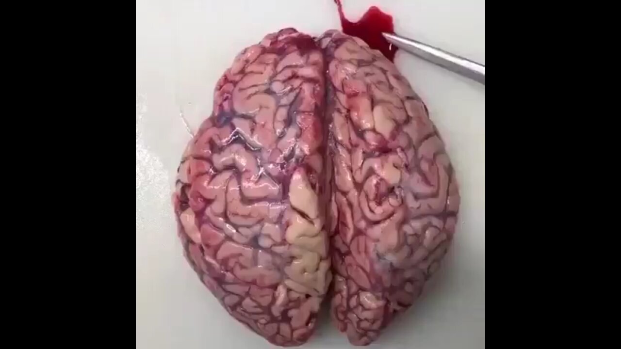 Vaxxbrain??