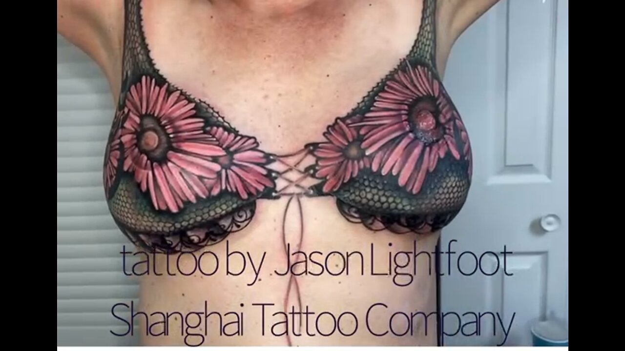 Double mastectomy scar cover up with tattooing and nipple reconstruction￼