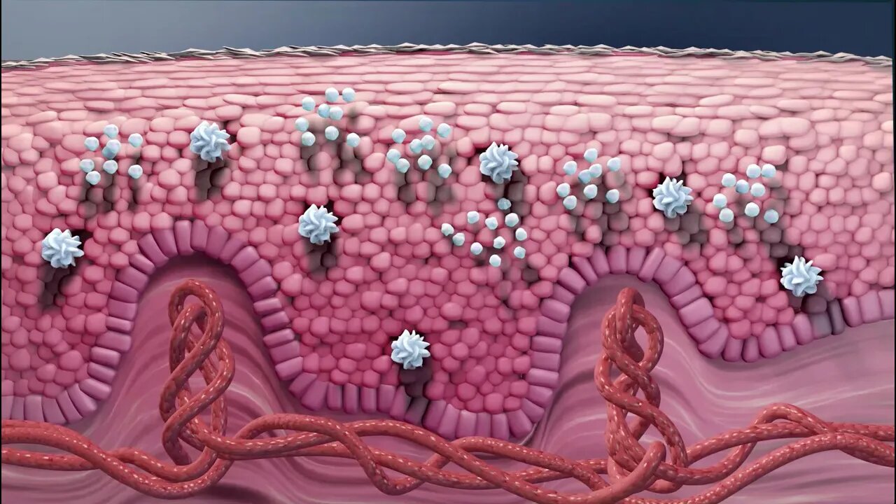 Tratamientos para la psoriasis