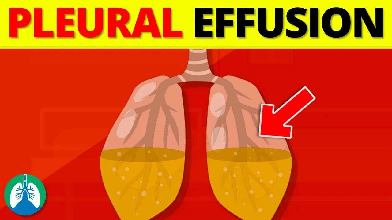 Pleural Effusion (Medical Definition) | Quick Explainer Video