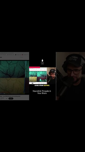 Would you let them put THESE in your brain?