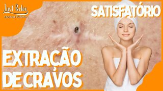 Só Relaxe Remoção de Cravos - Remove Blackheads and Pimples - Just Relax | Apenas Relaxe