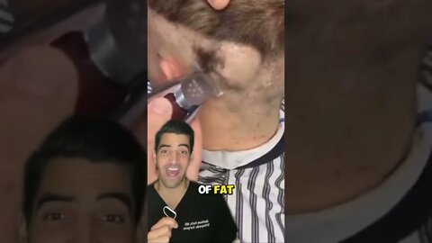 Big Skin Bump