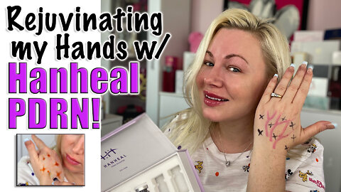 Rejuvinating my Hands with Hanheal Pdrn from AceCosm.com | Code Jessica10 Saves you Money!