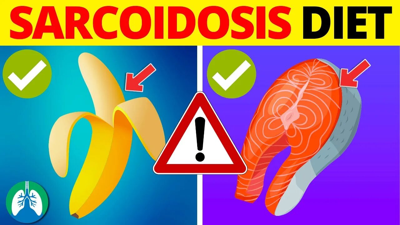 ONLY Eat These Food if You Have Sarcoidosis [WARNING]❗