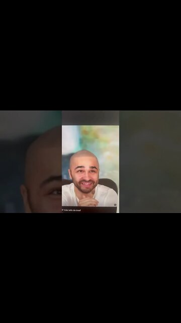 Who is the bald 25 year old. I am 52 and not even bald.