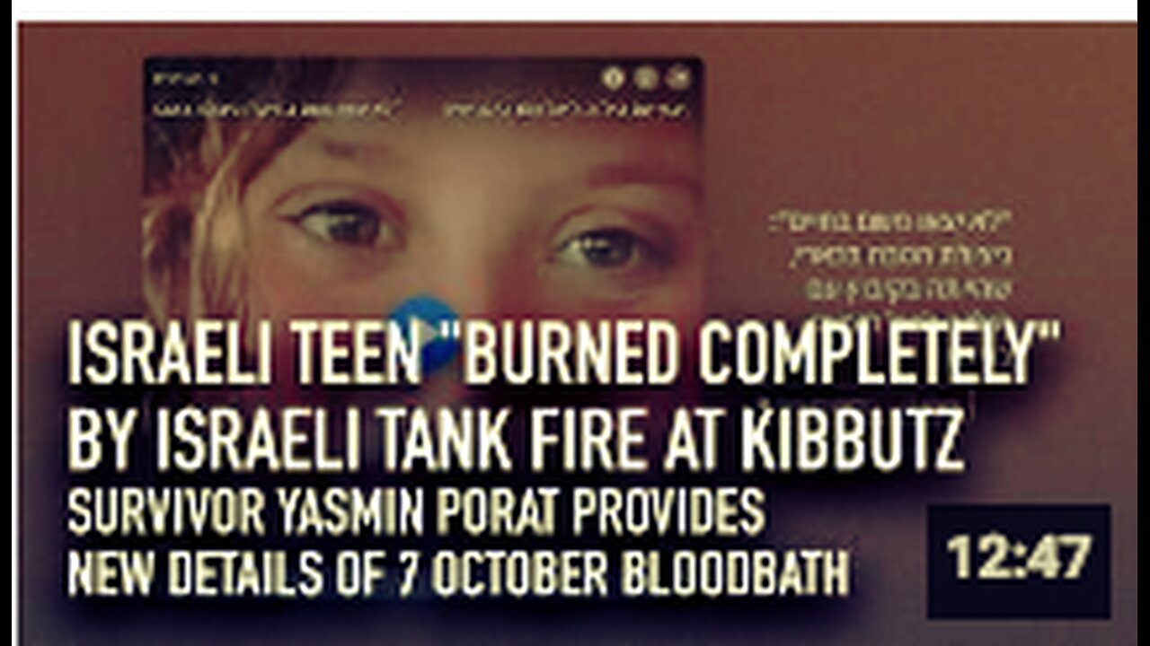 Israeli teen ”burned completely” by Israeli tank fire at kibbutz