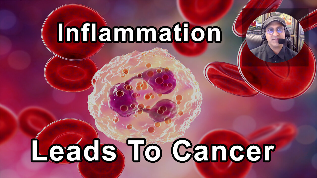 Inflammation Over Time Can Lead To Cancer - Sunil Pai, MD