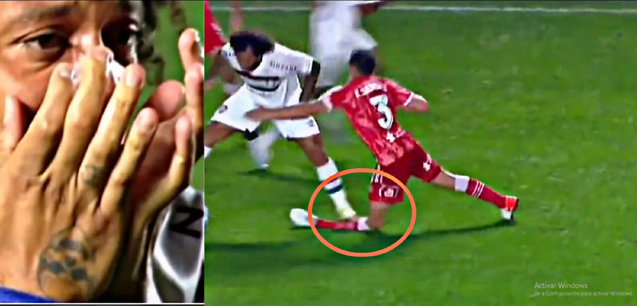 Marcelo Steps On Luciano Sanchez's Leg I Terrific Injury