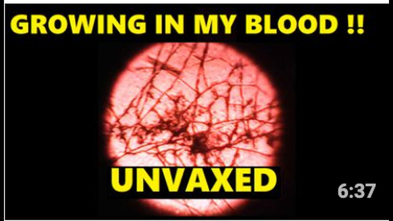 MY UNVAXED BLOOD FROM 4 MONTHS AGO HAS FORMED FIBRES !!