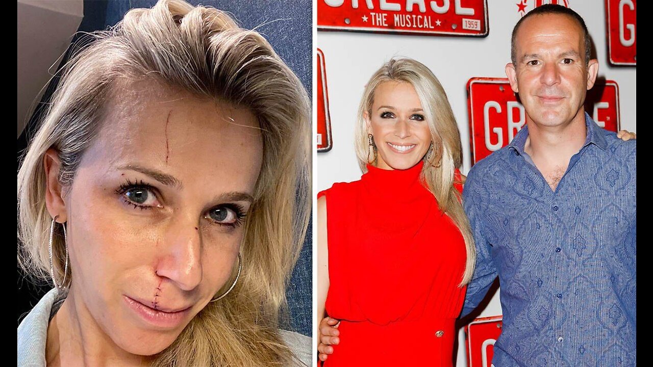 Martin Lewis' wife Lara Lewington sparks concern as she shares pic of 'stitched up' face