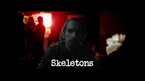 Skeletons (USA)