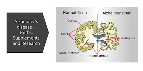 Alzheimer's Disease Natural Treatment