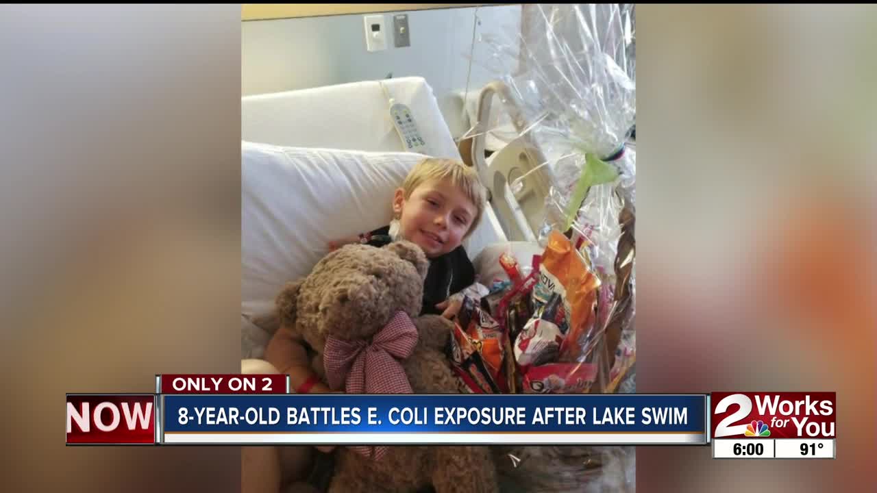 8-year-old battles E. coli exposure after lake swim