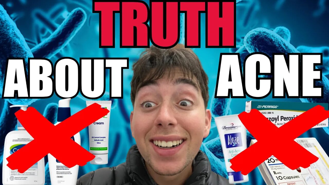 The HIDDEN TRUTH About Acne | @gentlemansgazette Stop Being Brainwashed