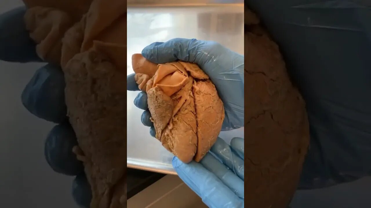 Can the Heart Survive Outside the Body?