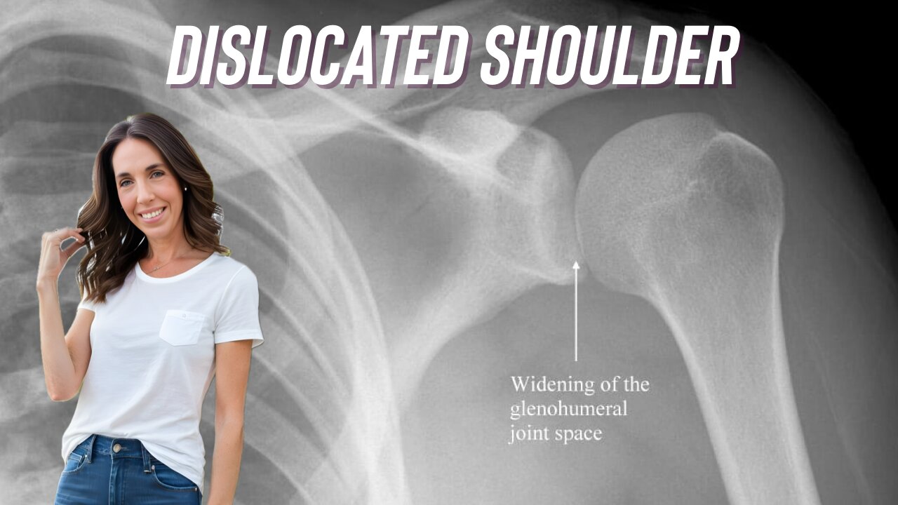 Dislocated Shoulder