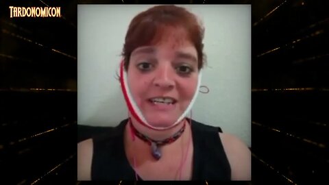 2023 01 23 1 help numb the pain