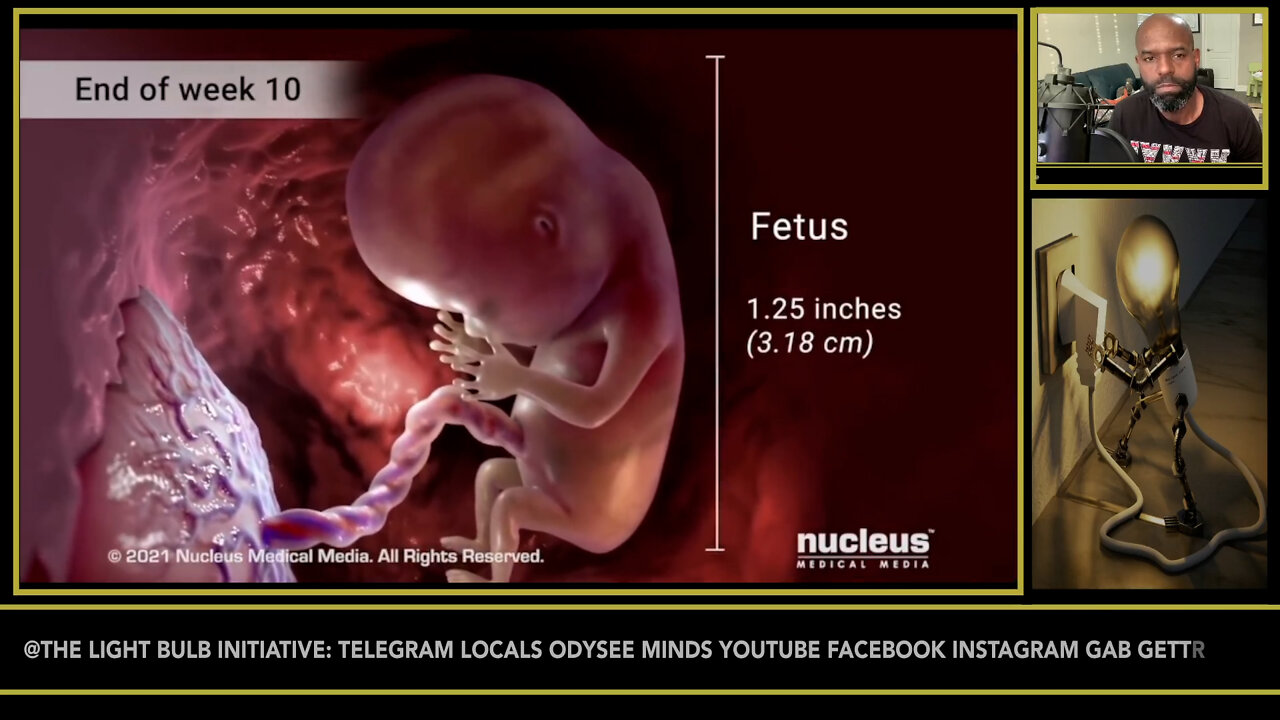 IT’S SIMPLE, YOU ARE EITHER PRO-LIFE OR PRO-DEATH