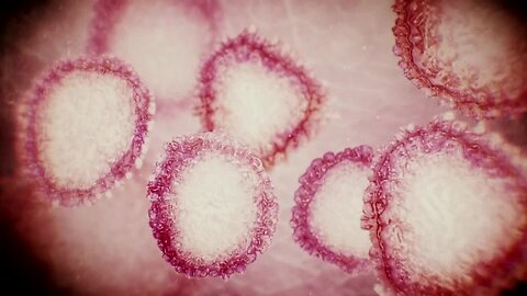 Wisconsin to get at least $10 million to help fight coronavirus