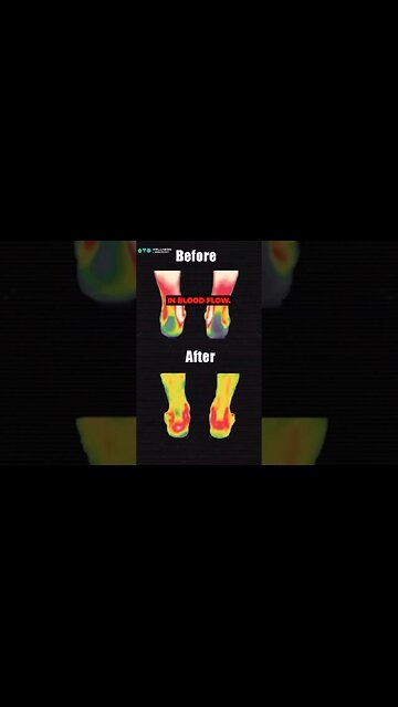 KINEON: Save your joints and relief pain! #jointpain #chronicpain #lasertherapy