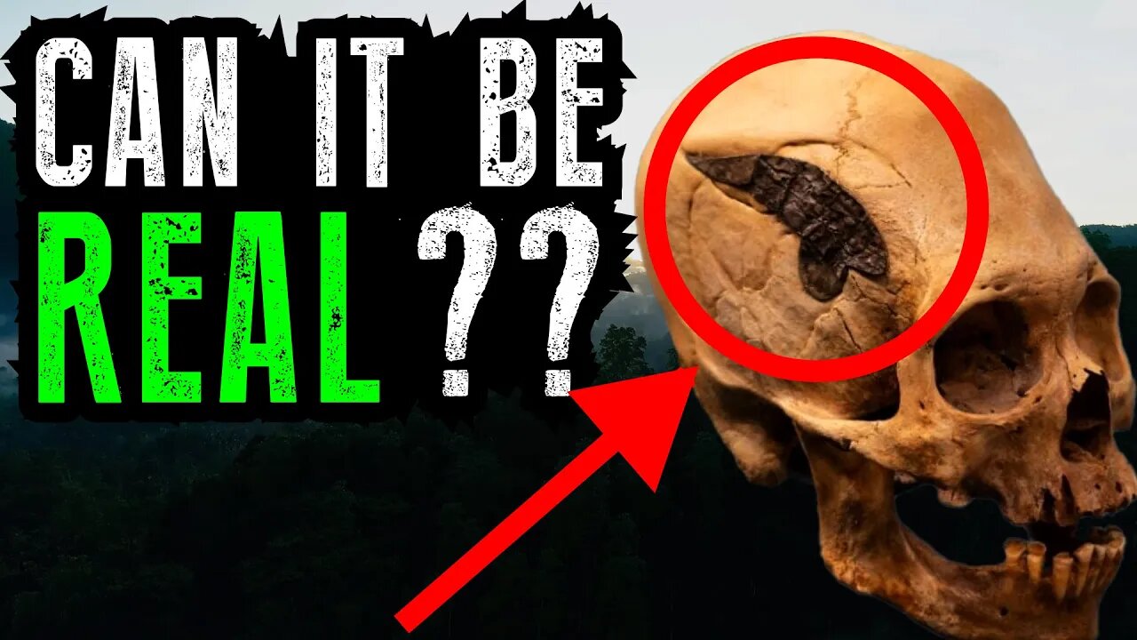 Ancient Skull Metal Implant Mystery