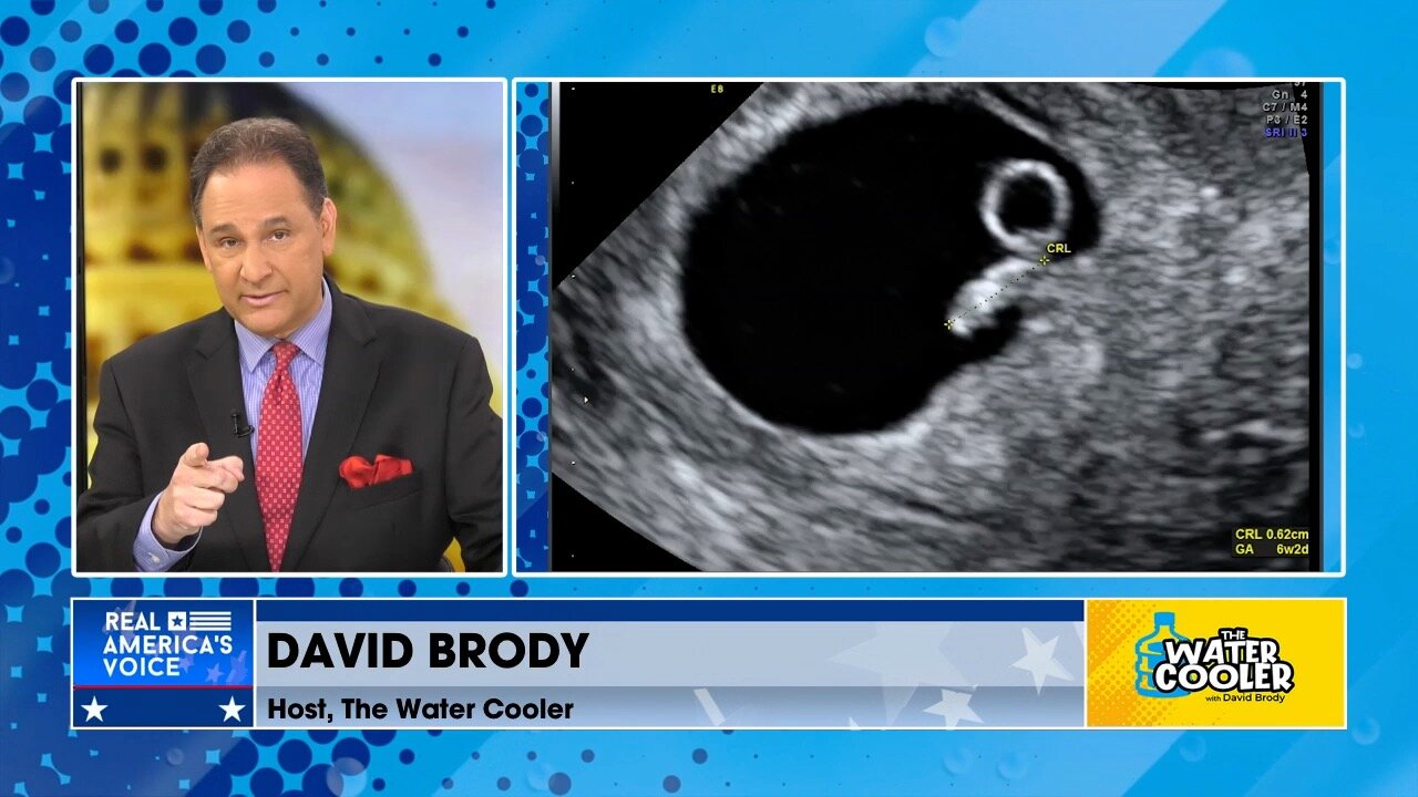 David Brody debunks the Left’s ‘antiquated and disproven’ theory on abortion