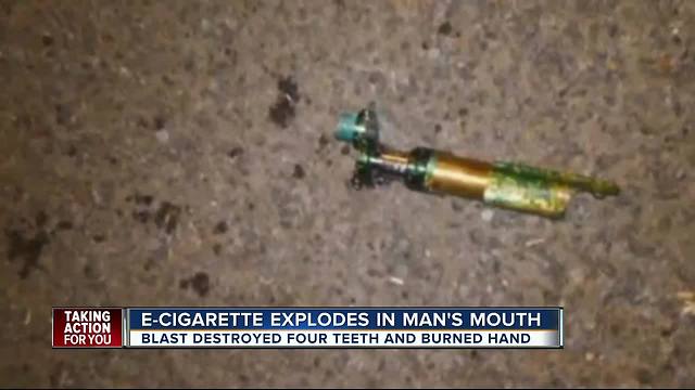 E-cig explodes in Hawaiian man's mouth, knocks out man's teeth
