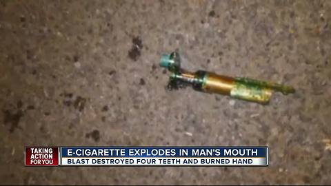 E-cig explodes in Hawaiian man's mouth, knocks out man's teeth