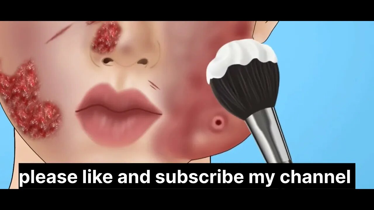 ASMR Face infection treatment//Animations//@uttam6361