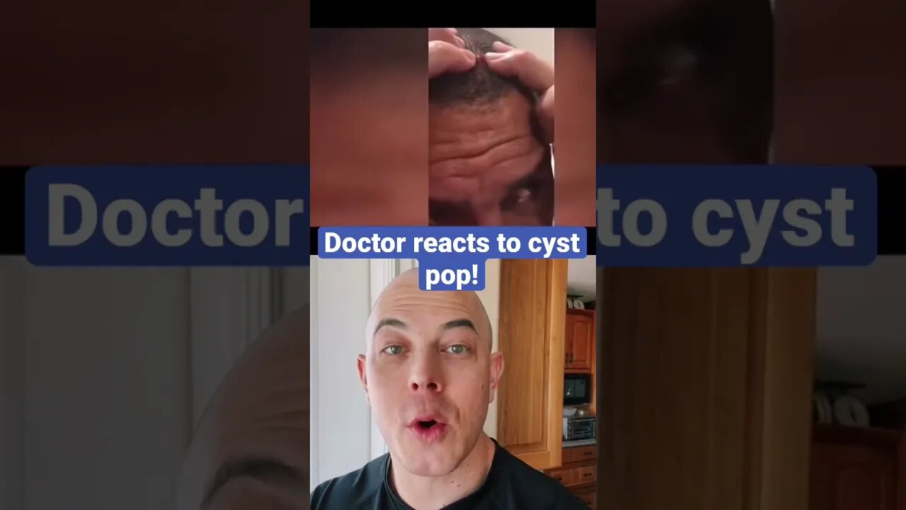 Doctor reacts to extremely satisfying cyst pop!