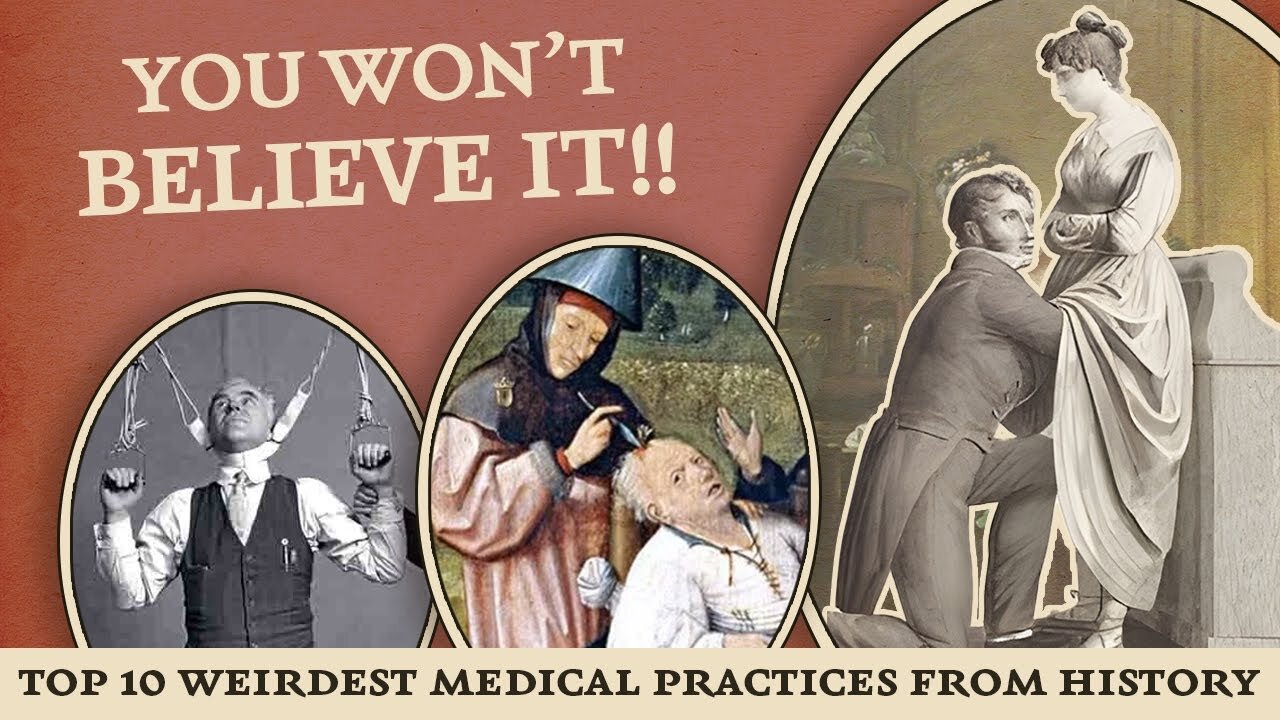 Top 10 Most Disgustingly Weird Medical Practices from History