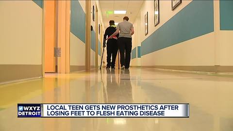 Teen fights to recover from flesh eating disease