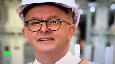 How Does Anthony Albanese React To Question About WHO Pandemic Treaty?