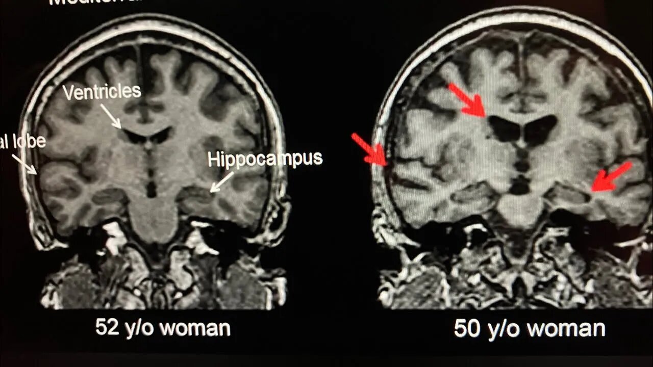 How food can make you smarter, vacuum blender enhancing nutrition, cleanse at water, #besthydrogen