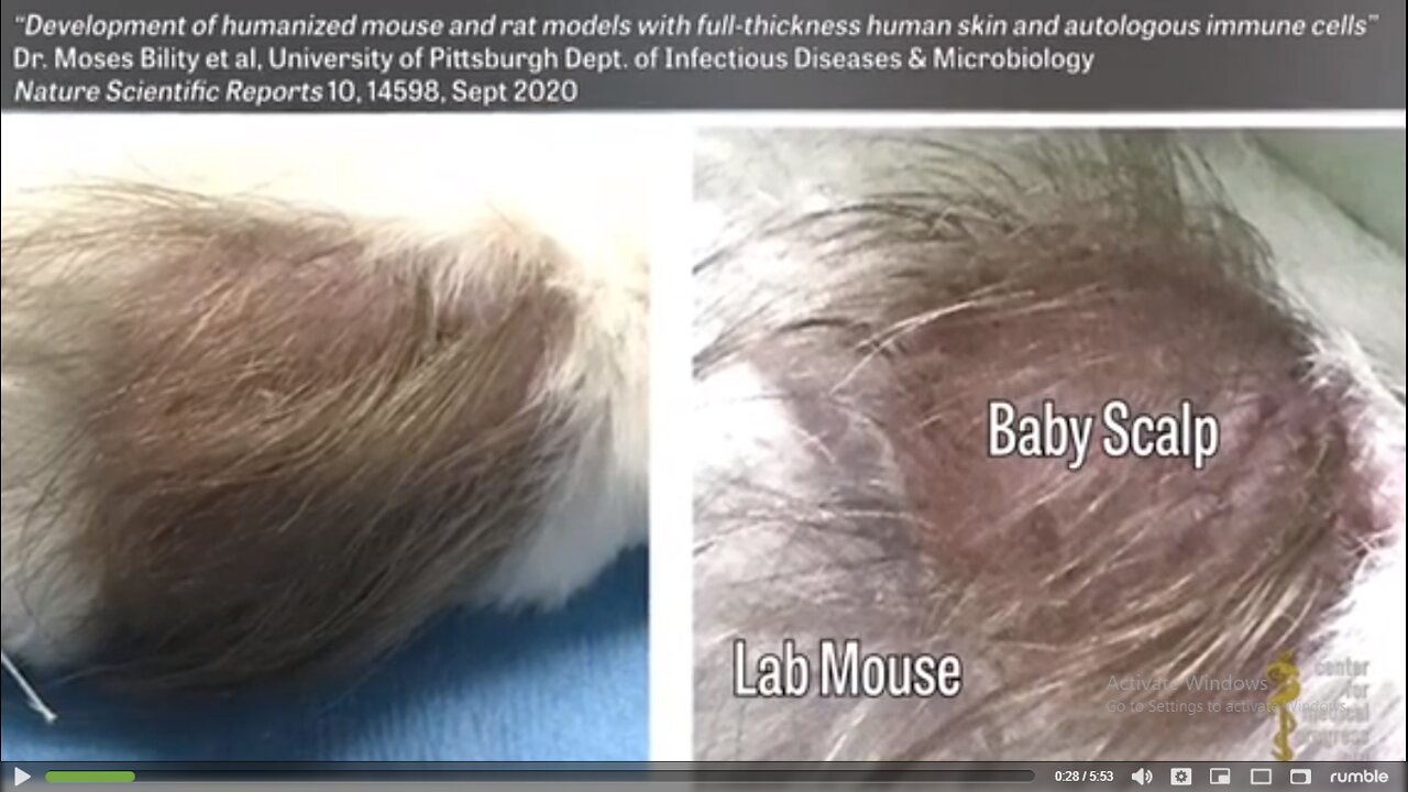 Fauci Funded Research Transplanted Fetal Scalps onto Lab Rats!