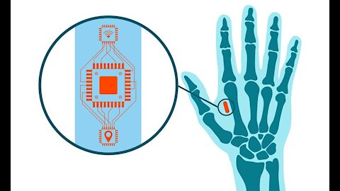 Klaus Schwab 2016 cipuri implantate in creier sau piele