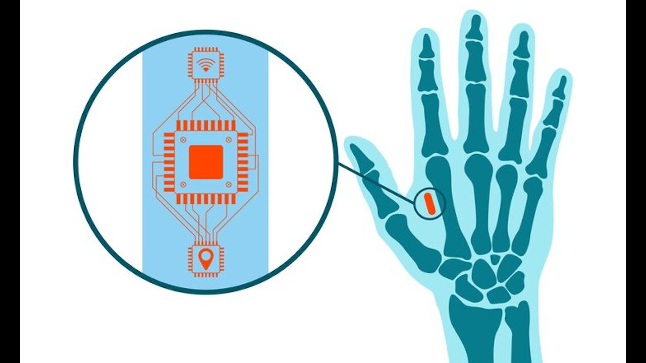 Klaus Schwab 2016 cipuri implantate in creier sau piele