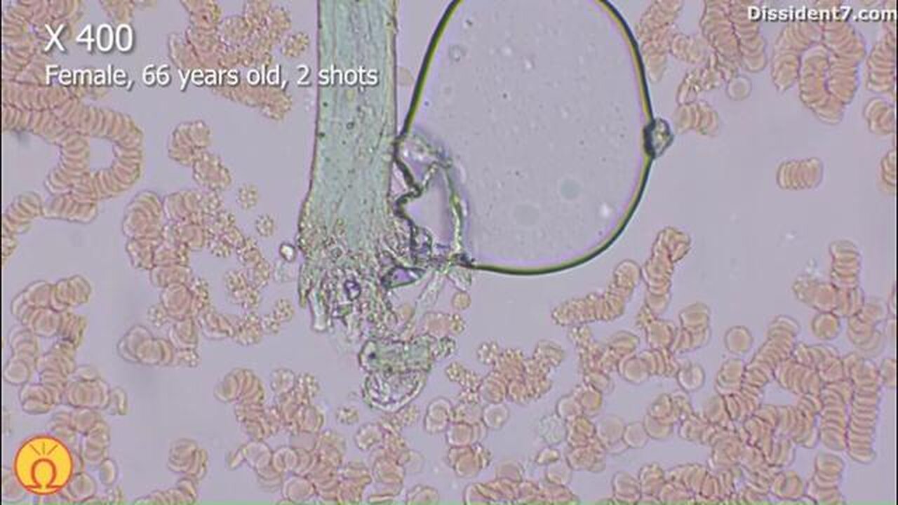 Next Dose 3: Do we still need proof? (English) (Examination of Covid Vaccines)