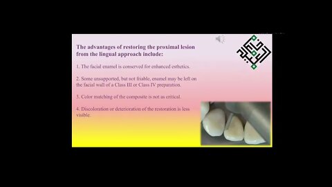 Operative L7 (Anterior Cavity Preparation Class III)