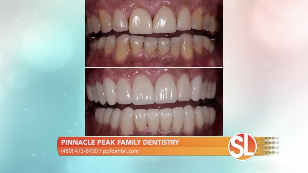 Pinnacle Peak Family Dentistry: Creating beautiful smiles