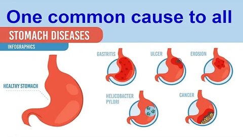 Chapter 1 - What is the unknown reason for chronic diseases in the stomach?