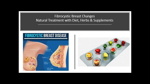 Fibrocystic Breast Changes - Natural Treatment Options